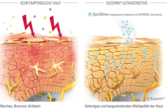 Die schwefelhaltige Salbe otbeliwajet die Haut