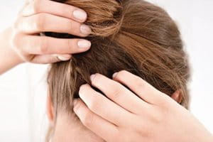 Eine Frau kratzt ihre juckende Kopfhaut